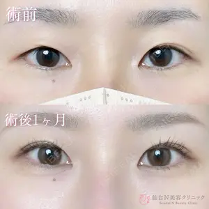 仙台N美容クリニック 小阪 捺稀医師の症例