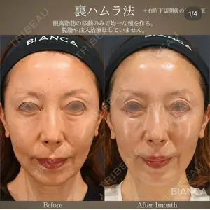 BIANCA銀座 魚谷 雄一朗医師の症例