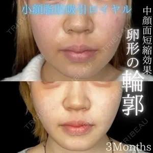THE FIRST CLINIC 多摩センター院 惟村 公郁医師の症例