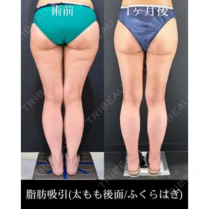 HAAB×DREAM BEAUTY CLINIC 東京本院 吉岡 修一医師の症例