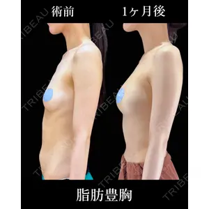 HAAB×DREAM BEAUTY CLINIC 東京本院 吉岡 修一医師の症例