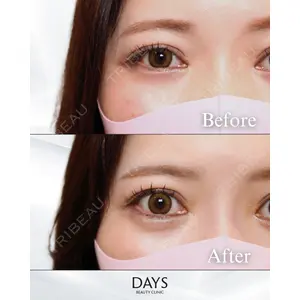 Days Beauty Clinic 蟹谷 莉麻医師の症例