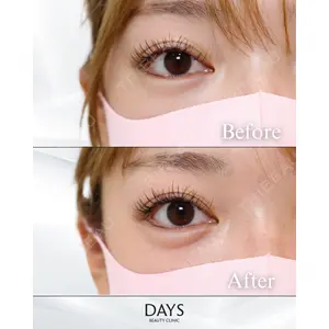 Days Beauty Clinic 蟹谷 莉麻医師の症例