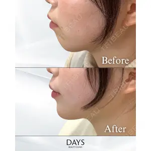 Days Beauty Clinic 蟹谷 莉麻医師の症例