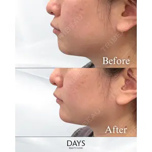 Days Beauty Clinic 蟹谷 莉麻医師の症例