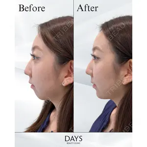 Days Beauty Clinic 蟹谷 莉麻医師の症例