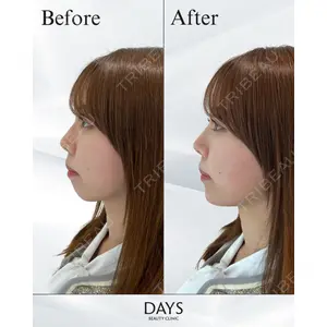 Days Beauty Clinic 蟹谷 莉麻医師の症例