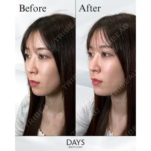 Days Beauty Clinic 蟹谷 莉麻医師の症例