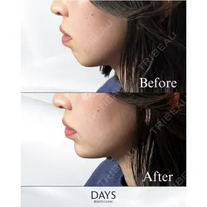 Days Beauty Clinic 蟹谷 莉麻医師の症例