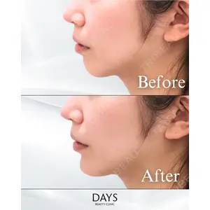 Days Beauty Clinic 蟹谷 莉麻医師の症例