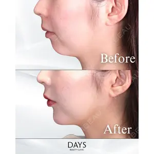Days Beauty Clinic 蟹谷 莉麻医師の症例