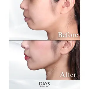 Days Beauty Clinic 蟹谷 莉麻医師の症例