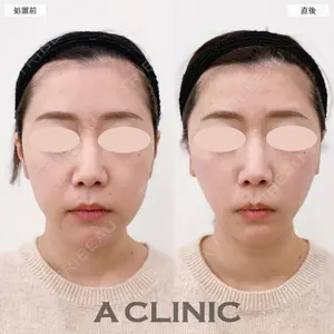 A CLINIC（エークリニック） 大阪院 田窪 賢志郎医師の症例