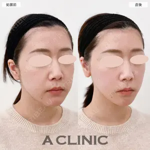 A CLINIC（エークリニック） 大阪院 田窪 賢志郎医師の症例