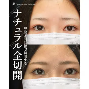 シンデレラ＆ダヴィンチクリニック 宮田 洋佑医師の症例