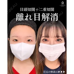 東京シンデレラ美容外科 新宿院 吉原 伯医師の症例