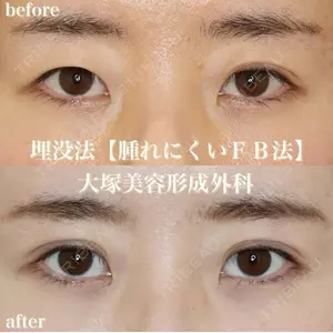 大塚美容形成外科 銀座本院 石井秀典医師の症例