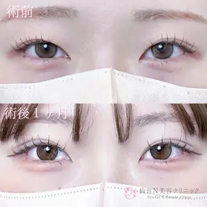 仙台N美容クリニック 小阪 捺稀医師の症例