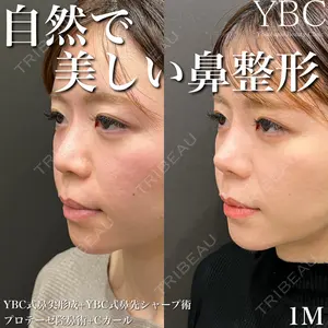 YBC横浜美容外科 池袋院 磯村 亮輔医師の症例