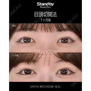 Stand by Beauty Clinic 望月 聖太医師の症例