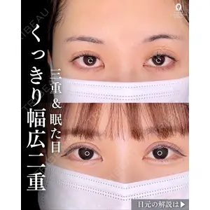 東京シンデレラ美容外科 新宿院 吉原 伯医師の症例