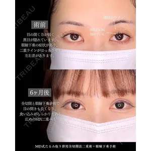 東京シンデレラ美容外科 新宿院 吉原 伯医師の症例