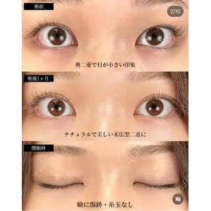 湘南美容クリニック 大阪梅田院 横谷 仁彦医師の症例
