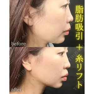 THE FIRST CLINIC 町田院 木暮 啓一郎医師の症例