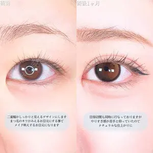 アリエル美容クリニック 大宮院 鈴木　桂介医師の症例