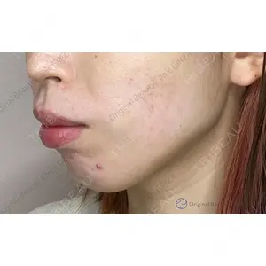 Original Beauty Clinic GINZA 佐藤玲史医師の症例