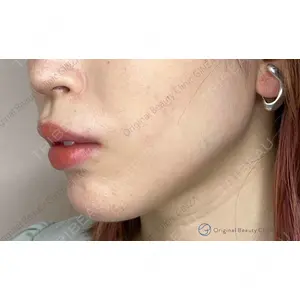 Original Beauty Clinic GINZA 佐藤玲史医師の症例