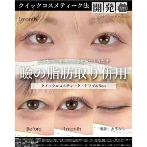 湘南美容クリニック 大阪梅田院 横谷 仁彦医師の症例
