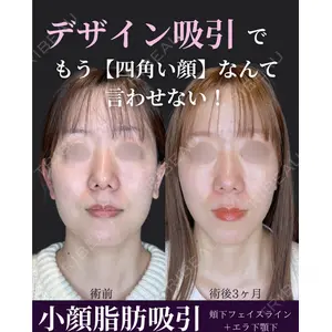 ルラ美容クリニック 京都院 矢田 玲奈医師の症例