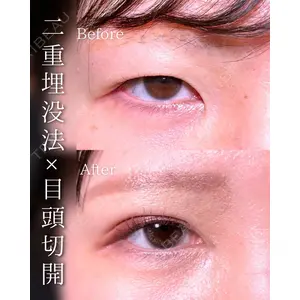 東京シンデレラ美容外科 池袋院 石井 達也医師の症例