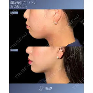 PRISM Beauty Clinicの症例