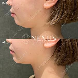 NEXUS CLINICの症例