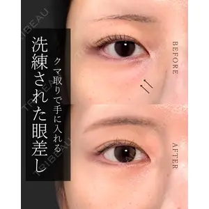 東京形成美容外科 船橋院 弓削田　浩主医師の症例