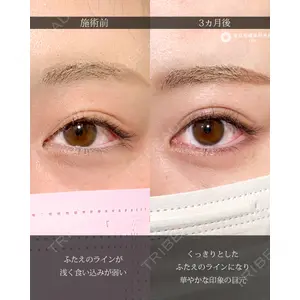 東京形成美容外科 船橋院 弓削田　浩主医師の症例