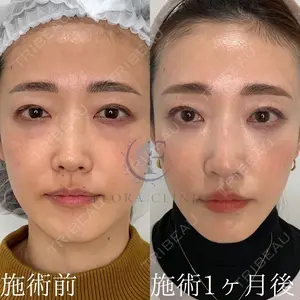 フローラクリニック 秋間雄策（さくちゃん先生）医師の症例