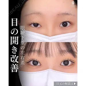 東京シンデレラ美容外科 新宿院 吉原 伯医師の症例