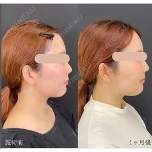 自由が丘ウェルエイジングビューティークリニックの症例