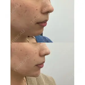 Next Tokyo Clinic 中村 有医師の症例