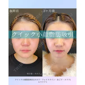 ルラ美容クリニック 札幌院 佐藤 雄紀医師の症例