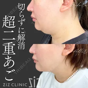 ziz CLINIC 村岡 史子医師の症例
