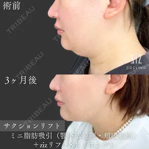 ziz CLINIC 村岡 史子医師の症例