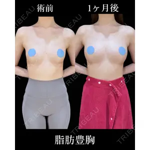 HAAB×DREAM BEAUTY CLINIC 東京本院 吉岡 修一医師の症例