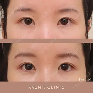 KAUNIS CLINIC（カウニスクリニック） 高野 敏郎医師の症例