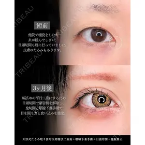 東京シンデレラ美容外科 新宿院 吉原 伯医師の症例