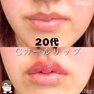 ルラ美容クリニック 札幌院 佐藤 雄紀医師の症例
