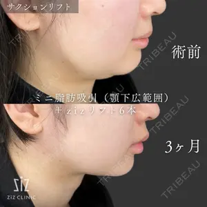 ziz CLINIC 村岡 史子医師の症例